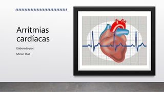 Arritmias
cardíacas
Elaborado por:
Mirian Díaz
 