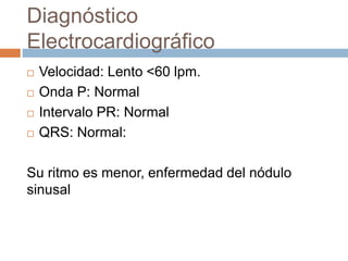 Diagnóstico
Electrocardiográfico
 Velocidad: Lento <60 lpm.
 Onda P: Normal
 Intervalo PR: Normal
 QRS: Normal:
Su ritmo es menor, enfermedad del nódulo
sinusal
 