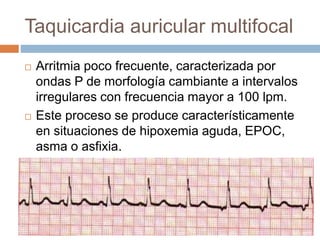Taquicardia auricular multifocal
 Arritmia poco frecuente, caracterizada por
ondas P de morfología cambiante a intervalos
irregulares con frecuencia mayor a 100 lpm.
 Este proceso se produce característicamente
en situaciones de hipoxemia aguda, EPOC,
asma o asfixia.
 