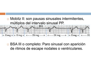 Mobitz II: son pausas sinusales intermitentes,
múltiplos del intervalo sinusal PP.
 BSA III o completo: Paro sinusal con aparición
de ritmos de escape nodales o ventriculares.
 