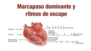 Marcapaso dominante y
ritmos de escapesc K L F Üf 1 S u E.pW'X“p Ñ 6ÁÚÁ',':“p jQ, 0'Jpx—.
e'jK,' gE N H 1u H H ] Y
é.Á—. E3 aH 1 NH ]
ipXpÚ jQ, BpxY F aH
JQj jQ cKJ)Á.(Q
„iÁWX' ÚÁ.KÚp,
/ Q Qh7iÁWX' jQ QÚ0p’Q
,p K.Á—.
gÁ 6p,,p. Q, .—jK,'
gE- ,pÚ pKJ“0K,pÚ
Ñ ,p K.Á—. E3
] P ]
ÁjÁ'hQ.WJÁ0K,pJ
,AM1NL s sH dpJ0p’pÚ'Ú j'XÁ.p.WQ Ñ jQ QÚ0p’Q
 