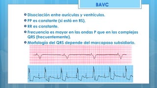 BAVC
! Disociación entre aurículas y ventrículos.
! PP es constante (si está en RS).
! RR es constante.
! Frecuencia es mayor en las ondas P que en los complejos
QRS (frecuentemente).
! Morfología del QRS depende del marcapaso subsidiario.
 