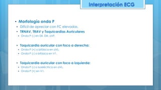 ▪ Morfología onda P
▪ Difícil de apreciar con FC elevadas.
▪ TRNAV, TRAV y Taquicardias Auriculares
▪ Onda P (-) en DII, DIII, aVF.
▪ Taquicardia auricular con foco a derecha:
▪ Onda P (+) o bifásica en aVL.
▪ Onda P (-) o bifásica en V1.
▪ Taquicardia auricular con foco a izquierda:
▪ Onda P (-) o isoeléctrica en aVL.
▪ Onda P (+) en V1.
Interpretación ECG
 