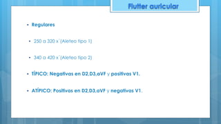 ▪ Regulares
▪ 250 a 320 x´(Aleteo tipo 1)
▪ 340 a 420 x´(Aleteo tipo 2)
▪ TÍPICO: Negativas en D2,D3,aVF y positivas V1.
▪ ATÍPICO: Positivas en D2,D3,aVF y negativas V1.
Flutter auricular
 