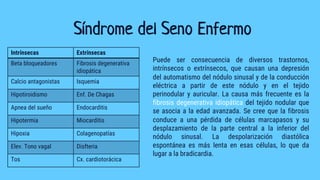 Síndrome del Seno Enfermo
Puede ser consecuencia de diversos trastornos,
intrínsecos o extrínsecos, que causan una depresión
del automatismo del nódulo sinusal y de la conducción
eléctrica a partir de este nódulo y en el tejido
perinodular y auricular. La causa más frecuente es la
fibrosis degenerativa idiopática del tejido nodular que
se asocia a la edad avanzada. Se cree que la fibrosis
conduce a una pérdida de células marcapasos y su
desplazamiento de la parte central a la inferior del
nódulo sinusal. La despolarización diastólica
espontánea es más lenta en esas células, lo que da
lugar a la bradicardia.
Intrínsecas Extrínsecas
Beta bloqueadores Fibrosis degenerativa
idiopática
Calcio antagonistas Isquemia
Hipotiroidismo Enf. De Chagas
Apnea del sueño Endocarditis
Hipotermia Miocarditis
Hipoxia Colagenopatías
Elev. Tono vagal Disfteria
Tos Cx. cardiotorácica
 