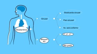 Bradiarritmia
Bloqueo
AV
Alto grado
1°, 2°, 3°
Sinusal
Paro sinusal
Bradicardia sinusal
Sx. seno enfermo
 