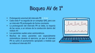 Bloqueo AV de 1°
§ Prolongación anormal del intervalo PR (> 0,2s).
§ Cada onda P va seguida de un complejo QRS, pero con
un intervalo PR prolongado de forma constante.
§ La prolongación del intervalo PR se debe, la mayoría
de las veces, a un retraso de la conducción dentro del
nódulo AV.
§ Los pacientes suelen estar asintomáticos.
§ Muchos de estos pacientes son especialmente
sintomáticos durante el ejercicio, ya que el intervalo
PR no sufre el acortamiento apropiado a medida que
se reduce el intervalo R-R
 
