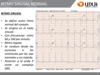 ARRITMIAS.pdf