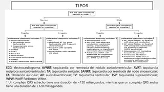 ARRITMIAS.pptx