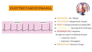 Seg Normal Definition ARRITMIAS CARDIACAS MÁS FRECUENTES IMPORTANTE | PDF