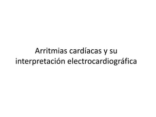 Arritmias cardíacas y su
interpretación electrocardiográfica
 