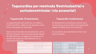 Taquicardias por reentrada Ventriculoatrial o
auriculoventricular (via accesorial)
Taquicardia Ortodrómica
La repolarización del ventrículo se realiza a
través del NAV y utiliza la vía accesoria como
brazo retrogrado de reentrada.
Forma mas frecuente de presentación y en el
ECG se muestra como una taquicardia regular
de QRS estrecho, de aspecto y manejo en el
servicio de urgencias (SU) idénticos en la
reentrada intranodal.
Taquiardia Antidrómica
Se despolariza el ventrículo a través de la
vía accesoria, lo que origina una taquicardia
regular de QRS ancho muy anormal.
Es una forma de presentación clínica muy
poco frecuente.
 