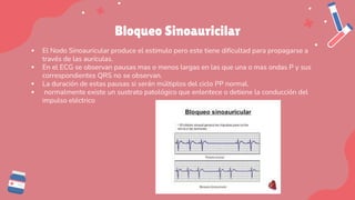 Bloqueo Sinoauricilar
▪ El Nodo Sinoauricular produce el estimulo pero este tiene dificultad para propagarse a
través de las aurículas.
▪ En el ECG se observan pausas mas o menos largas en las que una o mas ondas P y sus
correspondientes QRS no se observan.
▪ La duración de estas pausas si serán múltiplos del ciclo PP normal.
▪ normalmente existe un sustrato patológico que enlentece o detiene la conducción del
impulso eléctrico
 
