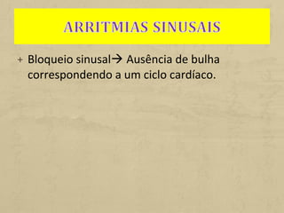 + Bloqueio sinusal Ausência de bulha
correspondendo a um ciclo cardíaco.
 