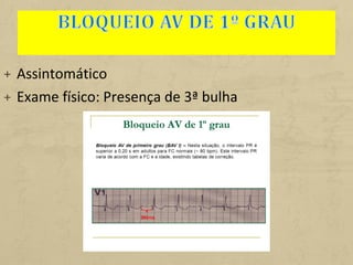 + Assintomático
+ Exame físico: Presença de 3ª bulha
 