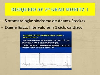 + Sintomatologia: síndrome de Adams-Stockes
+ Exame físico: Intervalo sem 1 ciclo cardíaco
 