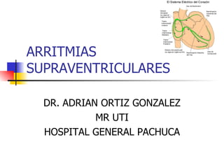 ARRITMIAS SUPRAVENTRICULARES DR. ADRIAN ORTIZ GONZALEZ MR UTI HOSPITAL GENERAL PACHUCA 