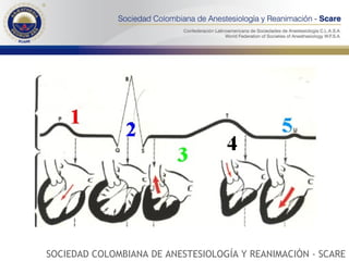 SOCIEDAD COLOMBIANA DE ANESTESIOLOGÍA Y REANIMACIÓN - SCARE 
