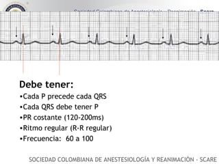 Debe tener: Cada P precede cada QRS Cada QRS debe tener P PR costante (120-200ms) Ritmo regular (R-R regular) Frecuencia:  60 a 100  SOCIEDAD COLOMBIANA DE ANESTESIOLOGÍA Y REANIMACIÓN - SCARE 