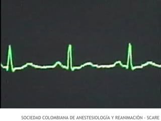 SOCIEDAD COLOMBIANA DE ANESTESIOLOGÍA Y REANIMACIÓN - SCARE 