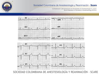SOCIEDAD COLOMBIANA DE ANESTESIOLOGÍA Y REANIMACIÓN - SCARE 