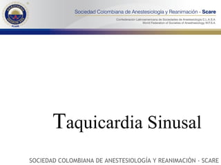 T aquicardia Sinusal SOCIEDAD COLOMBIANA DE ANESTESIOLOGÍA Y REANIMACIÓN - SCARE 