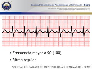 Frecuencia mayor a 90 (100) Ritmo regular SOCIEDAD COLOMBIANA DE ANESTESIOLOGÍA Y REANIMACIÓN - SCARE 