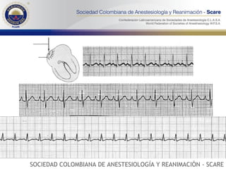 SOCIEDAD COLOMBIANA DE ANESTESIOLOGÍA Y REANIMACIÓN - SCARE 