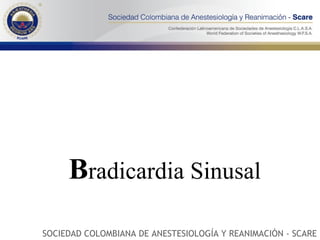 B radicardia Sinusal SOCIEDAD COLOMBIANA DE ANESTESIOLOGÍA Y REANIMACIÓN - SCARE 
