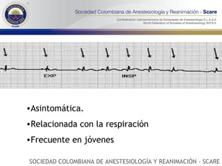 Asintomática. Relacionada con la respiración Frecuente en jóvenes SOCIEDAD COLOMBIANA DE ANESTESIOLOGÍA Y REANIMACIÓN - SCARE 