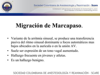 Migración de Marcapaso .  Variante de la arritmia sinusal, se produce una transferencia pasiva del ritmo sinusal dominante a focos automáticos mas bajos ubicados en la aurícula o en la unión AV. Suele ser expresión de un tono vagal aumentado. Hallazgo frecuente en jóvenes y atletas. Es un hallazgo benigno.  SOCIEDAD COLOMBIANA DE ANESTESIOLOGÍA Y REANIMACIÓN - SCARE 