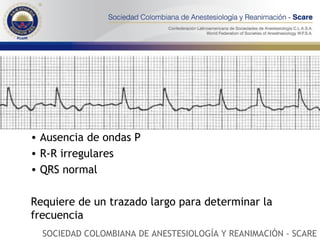 Ausencia de ondas P R-R irregulares QRS normal Requiere de un trazado largo para determinar la frecuencia SOCIEDAD COLOMBIANA DE ANESTESIOLOGÍA Y REANIMACIÓN - SCARE 