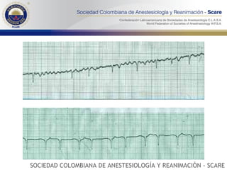 SOCIEDAD COLOMBIANA DE ANESTESIOLOGÍA Y REANIMACIÓN - SCARE 