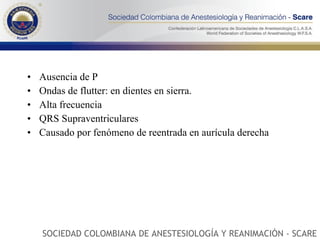 Ausencia de P Ondas de flutter: en dientes en sierra. Alta frecuencia QRS Supraventriculares Causado por fenómeno de reentrada en aurícula derecha SOCIEDAD COLOMBIANA DE ANESTESIOLOGÍA Y REANIMACIÓN - SCARE 