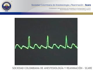 SOCIEDAD COLOMBIANA DE ANESTESIOLOGÍA Y REANIMACIÓN - SCARE 