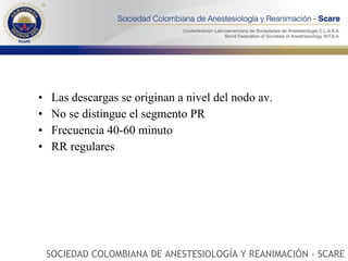 Las descargas se originan a nivel del nodo av. No se distingue el segmento PR Frecuencia 40-60 minuto RR regulares SOCIEDAD COLOMBIANA DE ANESTESIOLOGÍA Y REANIMACIÓN - SCARE 