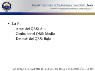 La P: Antes del QRS: Alto Oculta por el QRS: Medio Después del QRS: Bajo SOCIEDAD COLOMBIANA DE ANESTESIOLOGÍA Y REANIMACIÓN - SCARE 