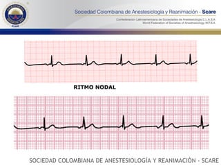 SOCIEDAD COLOMBIANA DE ANESTESIOLOGÍA Y REANIMACIÓN - SCARE 