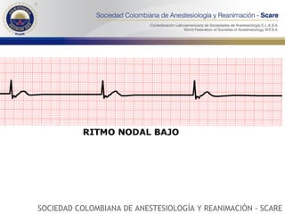 SOCIEDAD COLOMBIANA DE ANESTESIOLOGÍA Y REANIMACIÓN - SCARE 