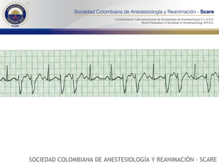 SOCIEDAD COLOMBIANA DE ANESTESIOLOGÍA Y REANIMACIÓN - SCARE 
