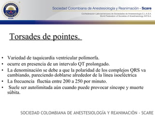 Torsades de pointes.  Variedad de taquicardia ventricular polimorfa. ocurre en presencia de un intervalo QT prolongado.  La denominación se debe a que la polaridad de los complejos QRS va cambiando, pareciendo doblarse alrededor de la línea isoeléctrica  La frecuencia  fluctúa entre 200 a 250 por minuto. Suele ser autolimitada aún cuando puede provocar síncope y muerte súbita.  SOCIEDAD COLOMBIANA DE ANESTESIOLOGÍA Y REANIMACIÓN - SCARE 