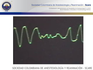 SOCIEDAD COLOMBIANA DE ANESTESIOLOGÍA Y REANIMACIÓN - SCARE 