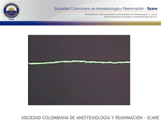 SOCIEDAD COLOMBIANA DE ANESTESIOLOGÍA Y REANIMACIÓN - SCARE 