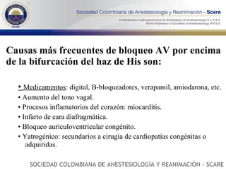 Causas más frecuentes de bloqueo AV por encima de la bifurcación del haz de His son:   •  Medicamentos : digital, B-bloqueadores, verapamil, amiodarona, etc.  •  Aumento del tono vagal.  •  Procesos inflamatorios del corazón: miocarditis.  •  Infarto de cara diafragmática.  •  Bloqueo auriculoventricular congénito.  •  Yatrogénico: secundarios a cirugía de cardiopatías congénitas o adquiridas.  SOCIEDAD COLOMBIANA DE ANESTESIOLOGÍA Y REANIMACIÓN - SCARE 
