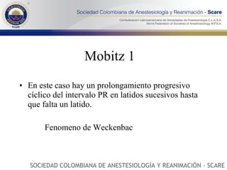 Mobitz 1 En este caso hay un prolongamiento progresivo cíclico del intervalo PR en latidos sucesivos hasta que falta un latido. Fenomeno de Weckenbac SOCIEDAD COLOMBIANA DE ANESTESIOLOGÍA Y REANIMACIÓN - SCARE 