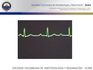 SOCIEDAD COLOMBIANA DE ANESTESIOLOGÍA Y REANIMACIÓN - SCARE 