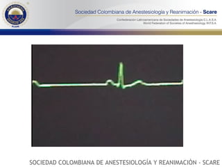 SOCIEDAD COLOMBIANA DE ANESTESIOLOGÍA Y REANIMACIÓN - SCARE 