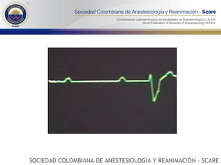 SOCIEDAD COLOMBIANA DE ANESTESIOLOGÍA Y REANIMACIÓN - SCARE 
