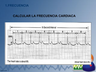 1.FRECUENCIA
CALCULAR LA FRECUENCIA CARDIACA
 