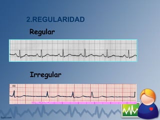 2.REGULARIDAD
Regular
Irregular
 